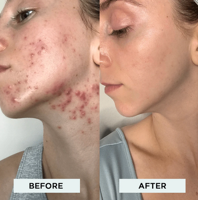 Illuminate Your Skin, Transform Your Confidence